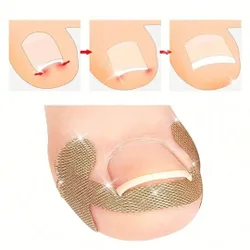 Piezas Pegatinas de corrección de uñas de los pies, parches para enderezar uñas encarnadas, cinta de corrección elástica para uñas curvas, tiras